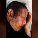 【閲覧注意】寝てるホームレスの “こめかみ” に蠢くものが･･･。近づいてよく見ると･･･。