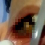 【閲覧注意】口の中に “この生き物” が何百匹もいたら死にたくなる･･･。