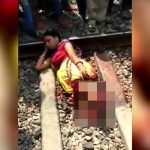 【閲覧注意】人身事故で両足切断 → 取り乱すこと無くめっちゃリラックス。