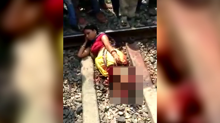 【閲覧注意】人身事故で両足切断 → 取り乱すこと無くめっちゃリラックス。