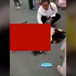 【閲覧注意】バイク事故で転倒した女性、足が “ありえない” 方向に･･･。