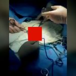 【閲覧注意】医師「腸の中から今までで一番長い “ディルド” 出てきた･･･」