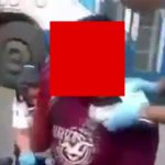 【閲覧注意】バイク事故の男性の顔がベロンと剥けちゃってるんだけど･･･。