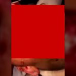 【超！閲覧注意】顔をマチェーテで切り刻まれた男、肉パックリのグロ動画･･･。