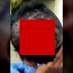 【閲覧注意】頭に穴が開いてる人間、中を覗いてみると･･･。