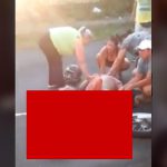 【閲覧注意】バイク事故現場。男性の左足が･･･。