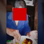 【超！閲覧注意】顔が無くなった男。これでも人は生きていける。