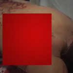 【閲覧注意】マチェーテの殺傷力がよく分かる “男性の身体” をご覧ください。