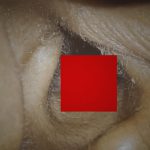 「耳が痛い･･･！」→ 病院で診てもらった結果･･･。