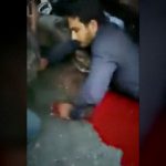 【超！閲覧注意】下半身の皮膚が “剥がれてしまった” グロ動画。