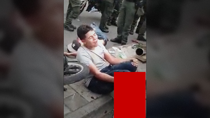 【閲覧注意】強盗犯の2人の男、”追いかけられて” こんな姿に･･･。