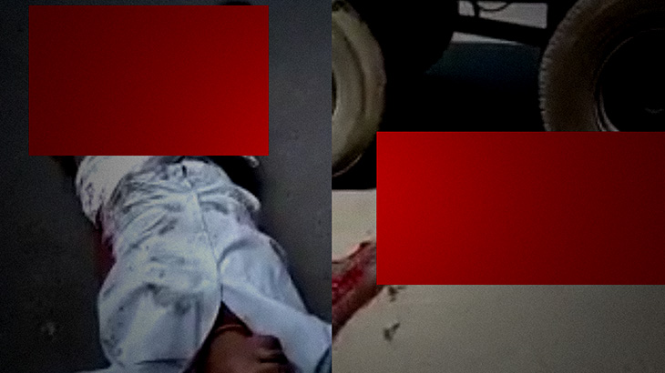 【閲覧注意】事故現場に “足を骨折した男性” と “即死した女性” が･･･。