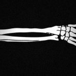 【閲覧注意】バイク事故を起こして倒れている女性、その少し離れた先に･･･。