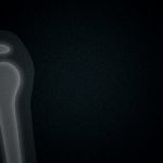 【閲覧注意】バイク事故で “男性の左肩” がヤバイ事になってしまったグロ動画･･･。