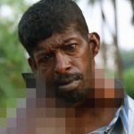 【衝撃映像】リアル “こぶとりじいさん” がインドで撮影される。