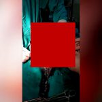 【閲覧注意】”20万人に1人” の赤ちゃんが生まれる瞬間のグロ動画。