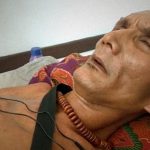 【衝撃映像】事故のあと、身体が “木のように固く” なってしまった人間。