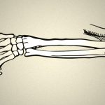 【閲覧注意】”左腕が切断” されてしまった女性のグロ動画。