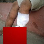 【閲覧注意】この男性の “左足” 、ヤバ過ぎる･･･。