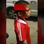 【閲覧注意】”頭を切り裂かれた” 男の子が立ってるんだけど･･･。