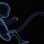 【閲覧注意】”生存率2%の赤ちゃん” を産んでしまった時の絶望感･･･。