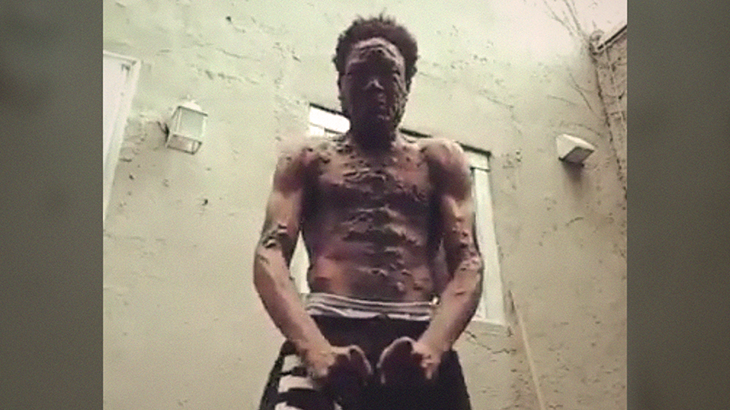 身体中にボツボツがある男性の “謎すぎる” 動画･･･。