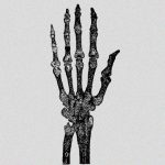 【超！閲覧注意】もう使い物にならなくなってしまった左手のグロ動画。