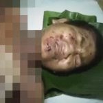 【閲覧注意】もはや “助かる見込みのない男性” を撮影したグロ動画･･･。