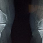 【閲覧注意】トラックに足を “すり潰された” グロ動画･･･。