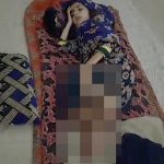 【衝撃映像】”寄生虫に感染” した7歳の女の子、右足が通常の3倍の大きさに･･･。