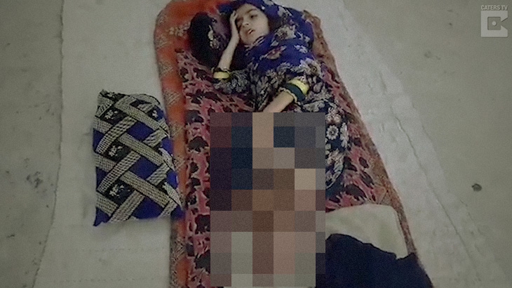 【衝撃映像】”寄生虫に感染” した7歳の女の子、右足が通常の3倍の大きさに･･･。