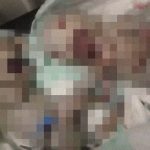 【閲覧注意】生まれたばかりの双子の赤ちゃんは “まるで宇宙人” のようだった。