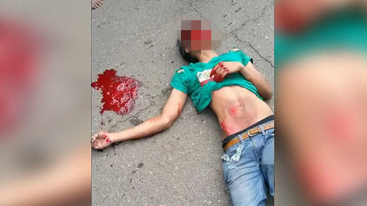 【閲覧注意】アマチュアスタントマン、盛大に事故ってしまう。