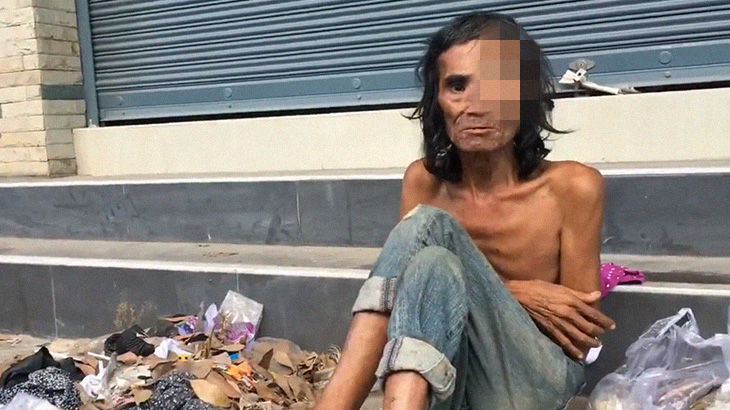 【衝撃映像】このホームレスの男性、顔がおかしなことになってる･･･。