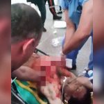 【閲覧注意】パックリ割れた胸に手を突っ込んでマッサージするグロ動画。