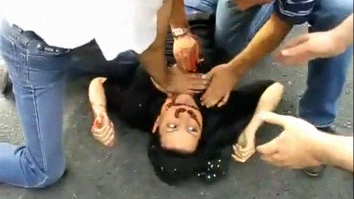 【閲覧注意】銃で撃たれた女性、鼻から大量の血が流れるグロ動画が怖すぎる･･･。