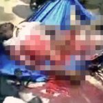 【閲覧注意】真っ二つになった男性、まだ生きてるものの「もう助からんやろ」ということで袋に詰められる。