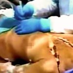 【超！閲覧注意】若い女性の死因を調べる20分間のグロ動画。