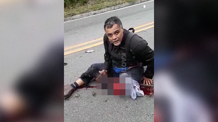 【閲覧注意】バイク事故を起こした男性、自分の左足を見て絶望するグロ動画･･･。