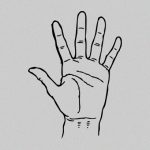 【閲覧注意】この左手、接合することはもう無理だった模様･･･。