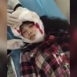 【閲覧注意】この女性の頭、ヤバイことになってたグロ動画･･･。