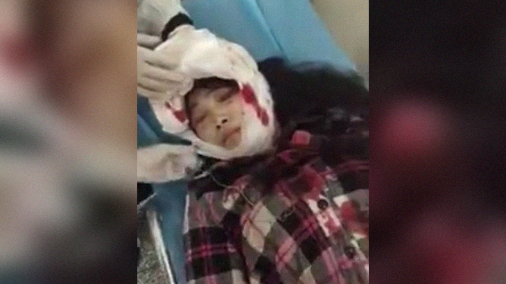 【閲覧注意】この女性の頭、ヤバイことになってたグロ動画･･･。