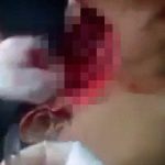 【閲覧注意】マチェーテで首をごっそり削ぎ取られてしまったグロ動画。