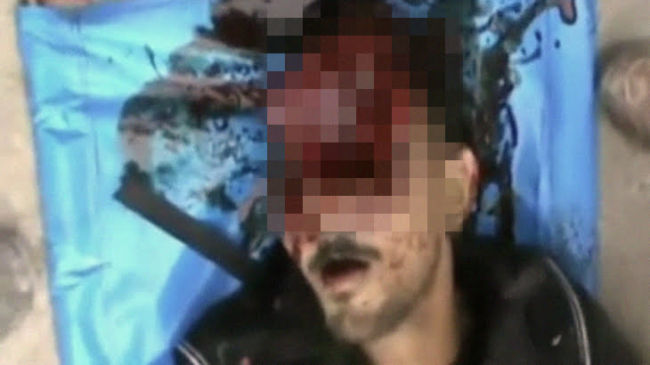 【閲覧注意】鼻から上が無くなってしまった男性のグロ動画。