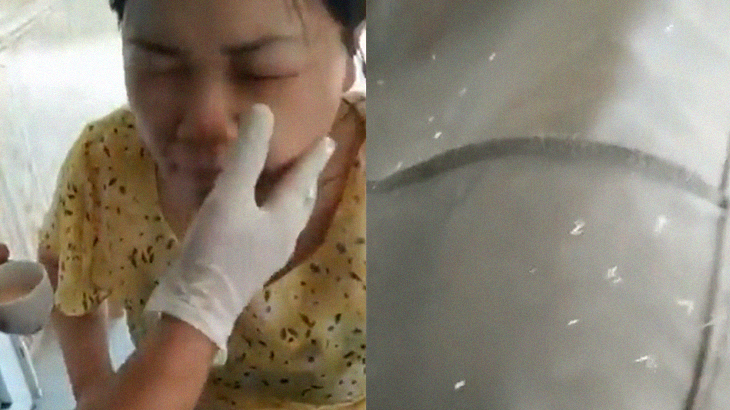 【衝撃映像】女性患者「なんか顔が痛いんです･･･」→ 寄生虫だらけでした。