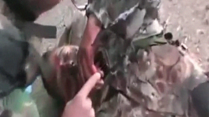 【閲覧注意】爆弾により下半身を吹き飛ばされた兵士、もう助からない･･･。