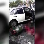 【閲覧注意】自動車事故で両足を失ってしまったドライバー。