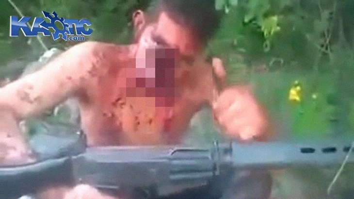 【閲覧注意】銃で顔を吹き飛ばされた男、親指を立てるほど余裕。