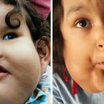 【衝撃映像】顔に大きな腫瘍を持って生まれてしまった男の子。