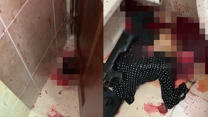 【超！閲覧注意】散弾銃で自殺した人間、顔が吹き飛ばされてしまうグロ動画･･･。